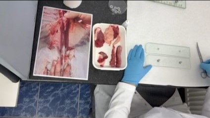 Testarea cărnii de porc la DSVSA Constanța, o măsură crucială pentru sănătatea publică Testarea cărnii de porc la DSVSA Constanța, o măsură crucială pentru sănătatea publică